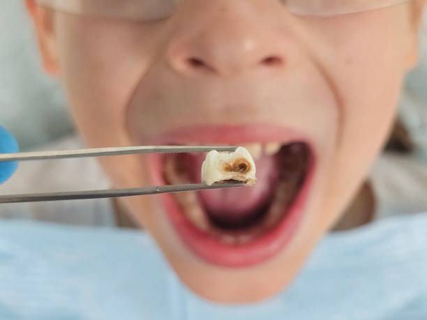 Best Emergency Treatment for Jaw Pain or Injury in Westwood, MI
